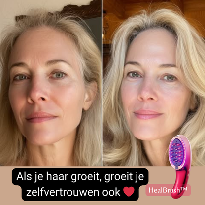 HealBrush™ Complete basis voor Gezonder Haar