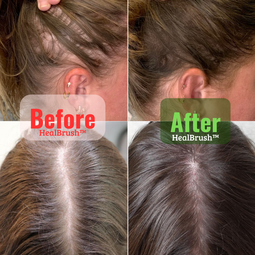 HealBrush™ 4-in-1 Haargroeiborstel