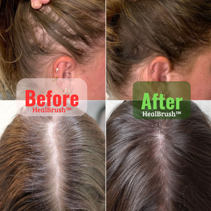 HealBrush™ 4-in-1 Haargroeiborstel
